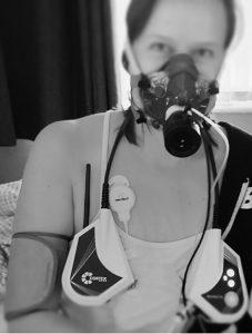 Research: Measuring everyday ME/CFS physical abnormalities at home